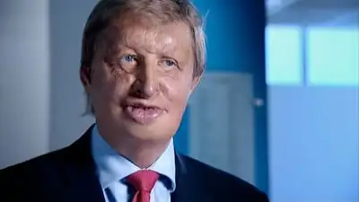 The Worlds First Face Transplant