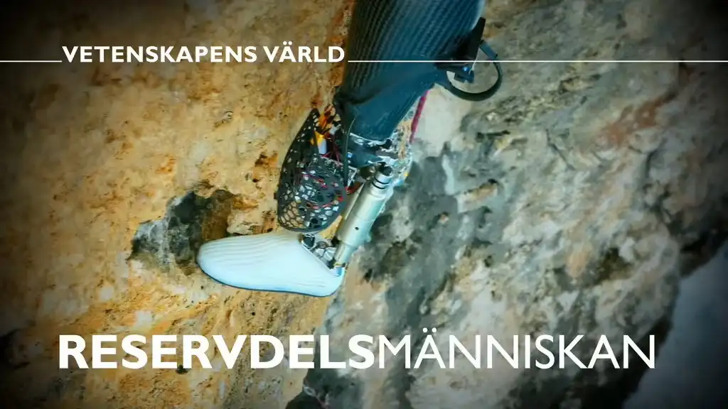 Reservdelsmänniskan